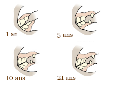 Evolution de la dentition du cheval